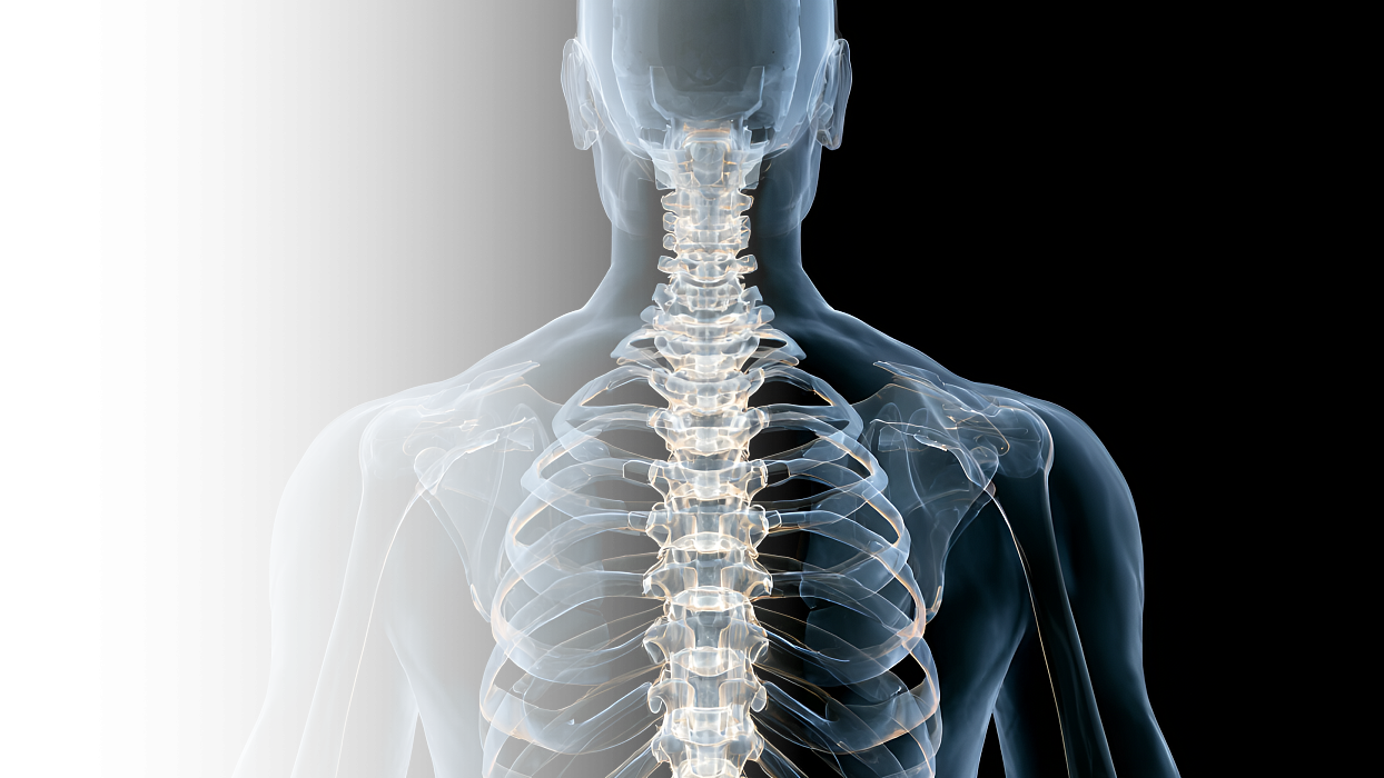 Грудная ламинэктомия