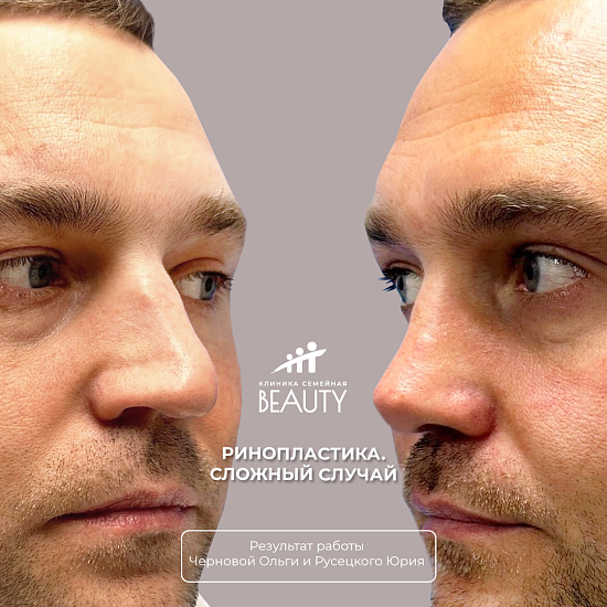 Примеры работ пластического хирурга Черновой О.В.