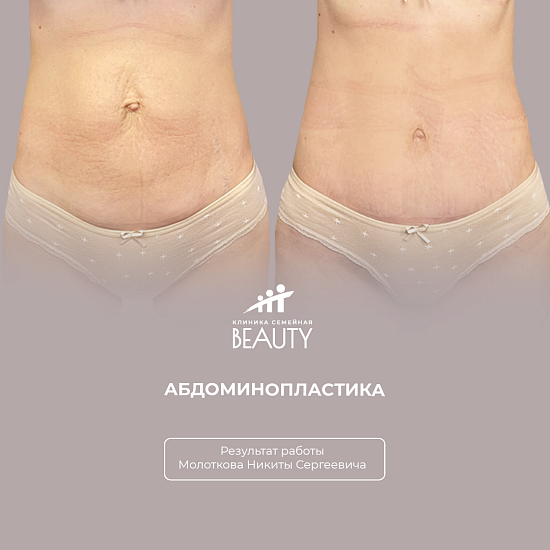 Примеры работ пластического хирурга Молоткова Н.С.