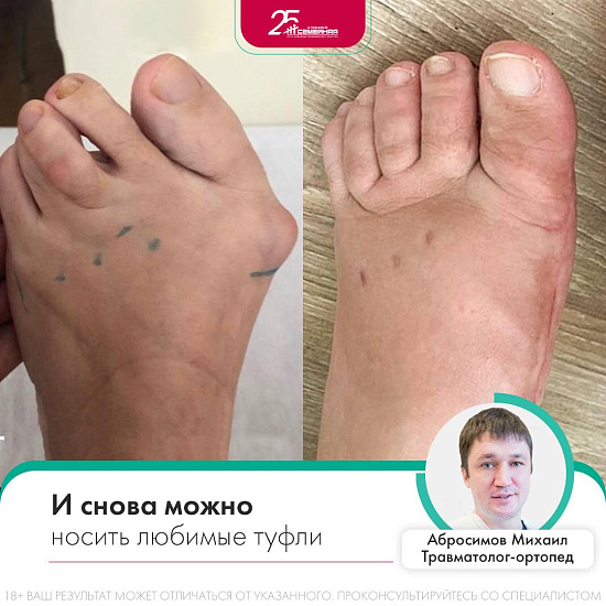 И снова можно носить туфли