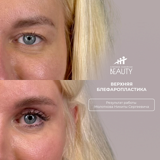 Примеры работ пластического хирурга Молоткова Н.С.