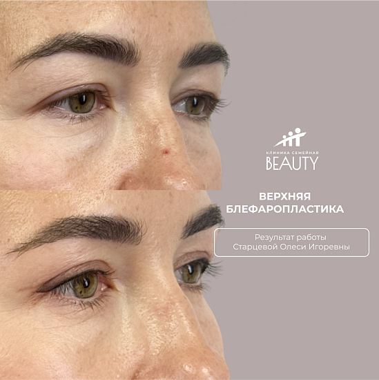 Примеры работ пластического хирурга Старцевой О.И.