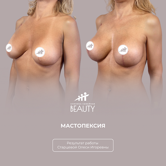 Примеры работ пластического хирурга Старцевой О.И.