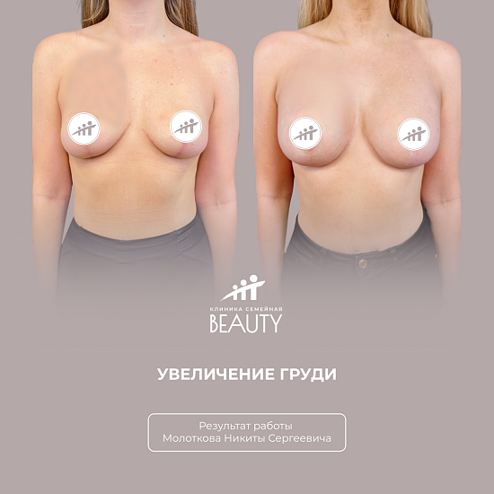 Примеры работ пластического хирурга Молоткова Н.С.