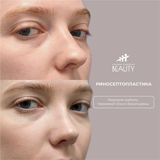 Примеры работ пластического хирурга Черновой О.В.