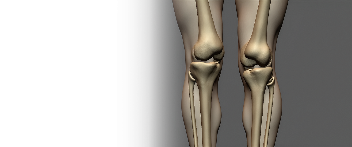 Артродез суставов