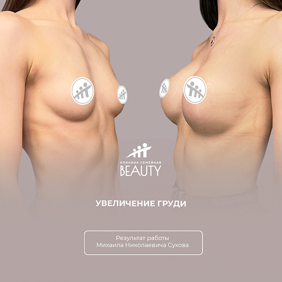 Примеры работ пластического хирурга Сухова М.Н.