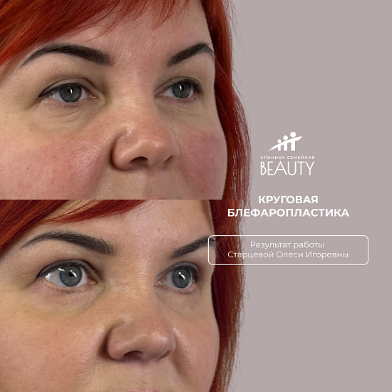 Примеры работ пластического хирурга Старцевой О.И.