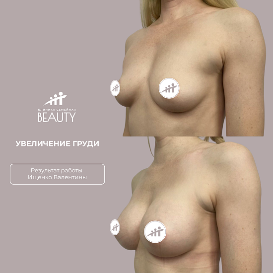 Примеры работ пластического хирурга Ищенко В.И.