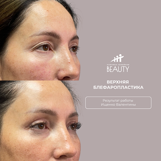 Примеры работ пластического хирурга Ищенко В.И.