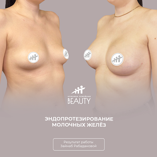 Примеры работ пластического хирурга Рабадановой З.М.