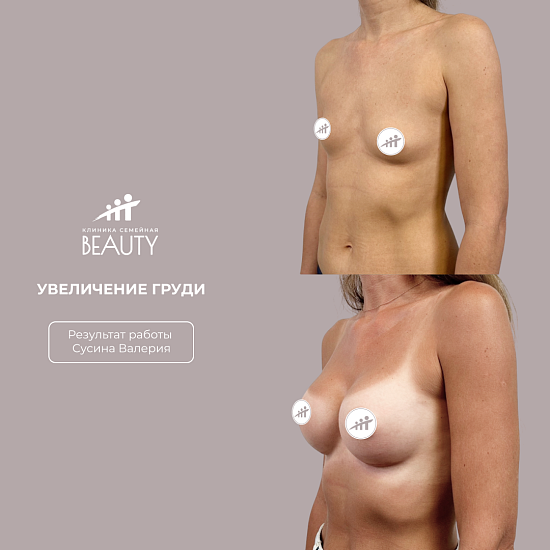 Примеры работ пластического хирурга Сусина В.С.