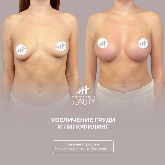 Примеры работ пластического хирурга Молоткова Н.С.