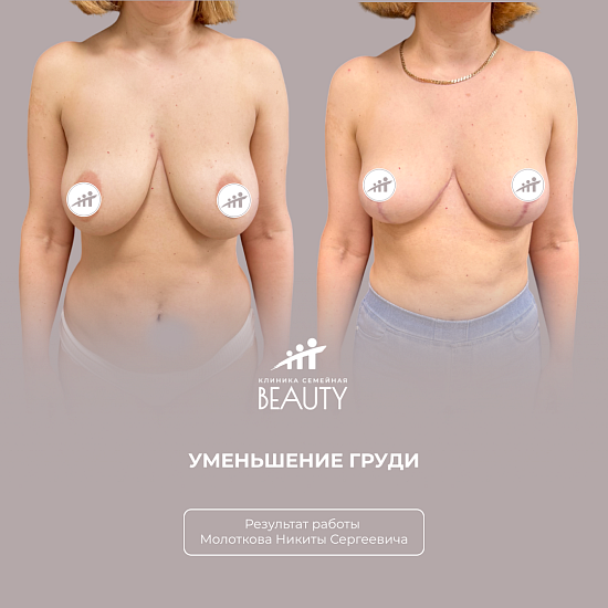 Примеры работ пластического хирурга Молоткова Н.С.