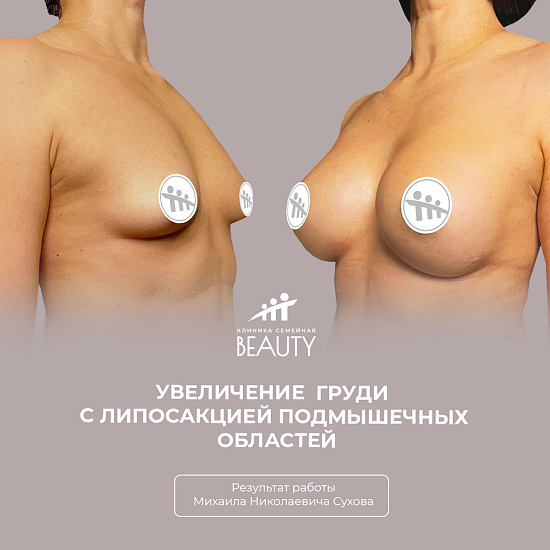 Примеры работ пластического хирурга Сухова М.Н.