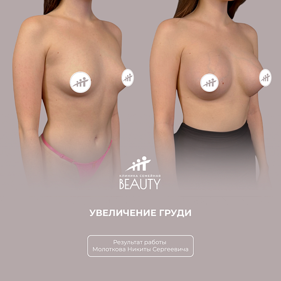 Примеры работ пластического хирурга Молоткова Н.С.