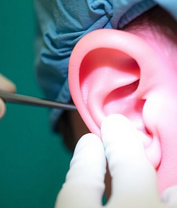 Шунтирование барабанной полости