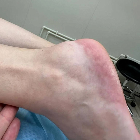 Неправильная обувь