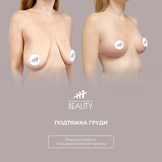 Примеры работ пластического хирурга Старцевой О.И.
