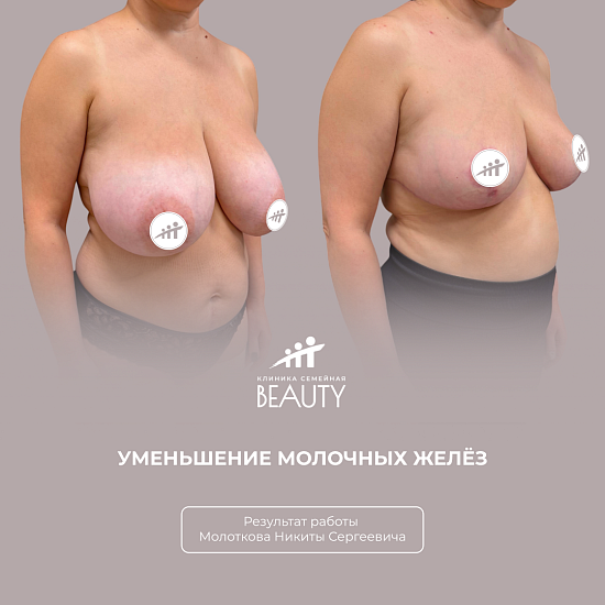 Примеры работ пластического хирурга Молоткова Н.С.