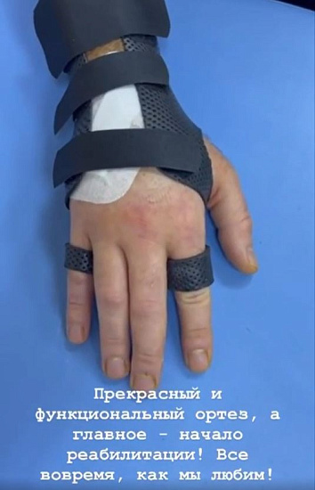 Перелом кисти хирурга