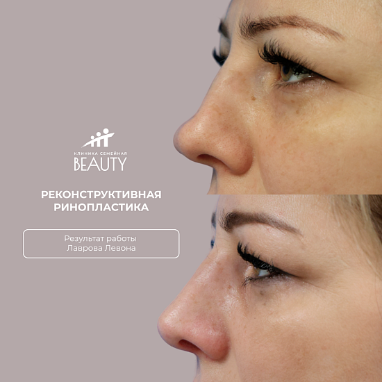 Примеры работ пластического хирурга Лаврова Л.А.