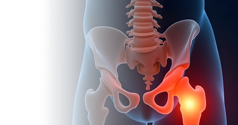 УЗИ тазобедренного сустава