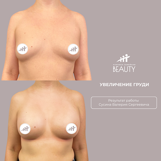 Примеры работ пластического хирурга Сусина В.С.