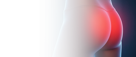 Иссечение свищей лазером