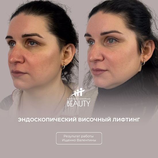 Примеры работ пластического хирурга Ищенко В.И.