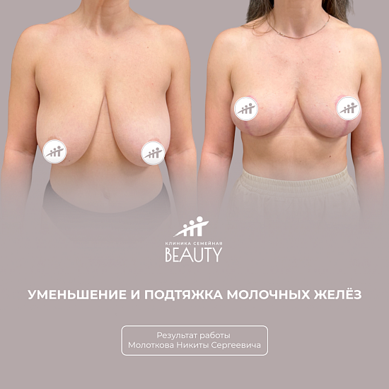 Примеры работ пластического хирурга Молоткова Н.С.