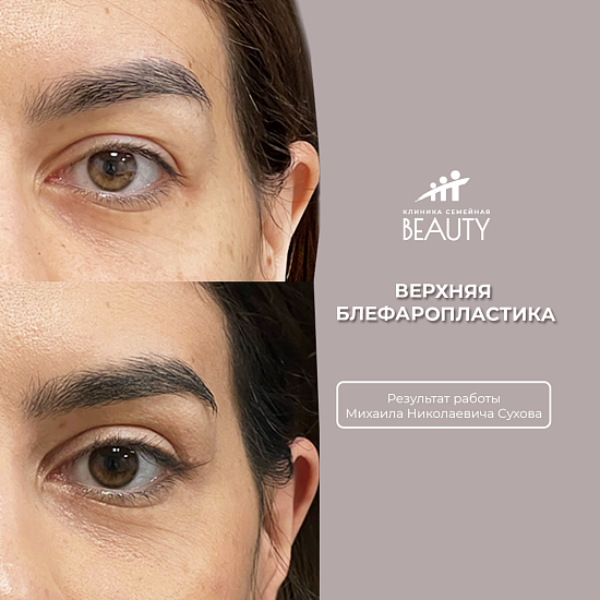 Примеры работ пластического хирурга Сухова М.Н.