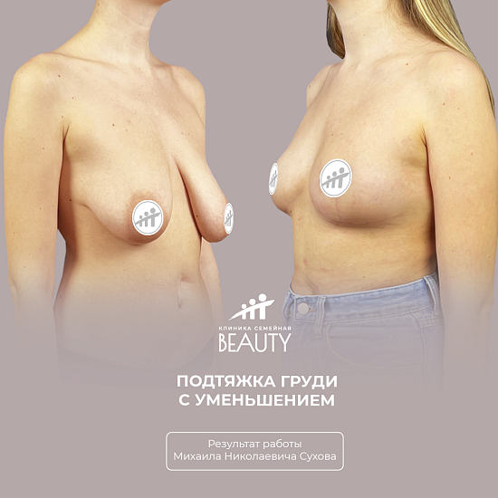 Примеры работ пластического хирурга Сухова М.Н.