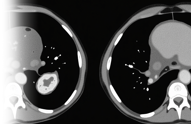 КТ брюшной полости и забрюшинного пространства