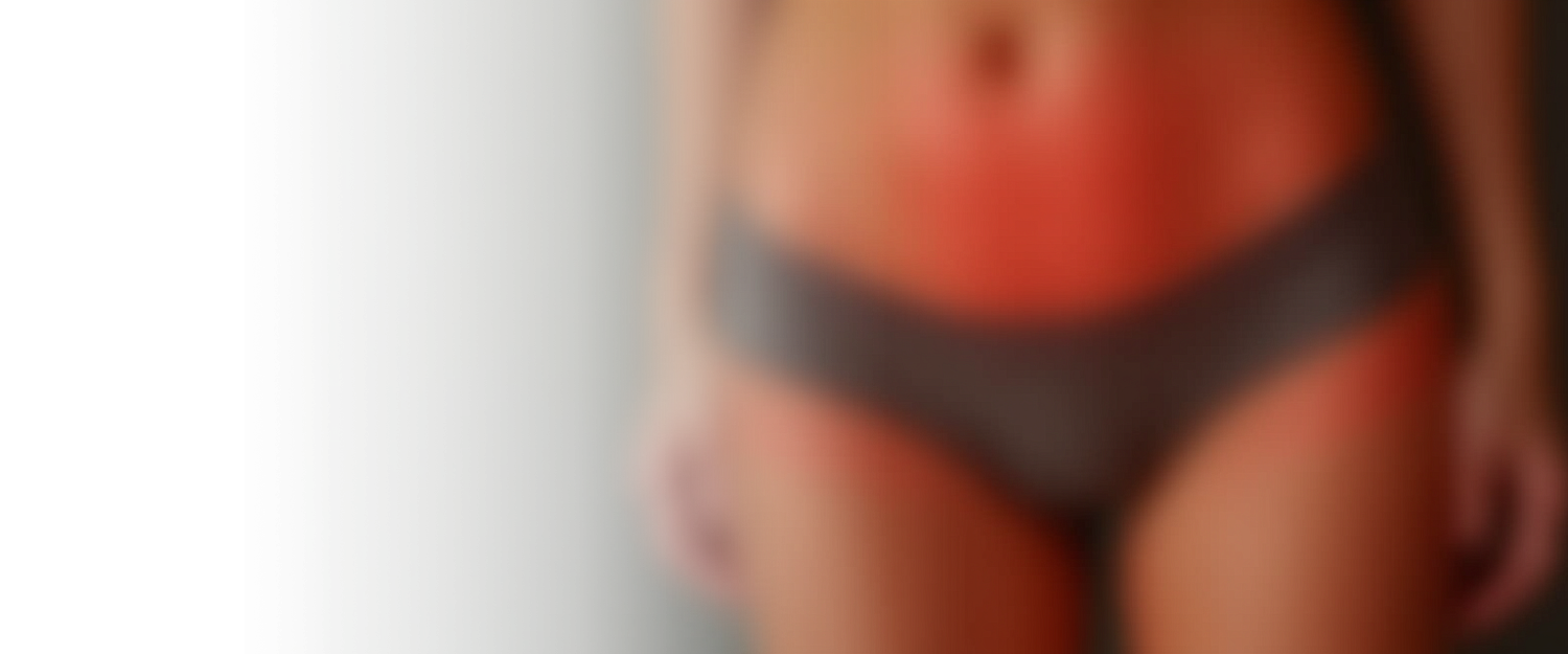 Вылущивание кисты бартолиновой железы