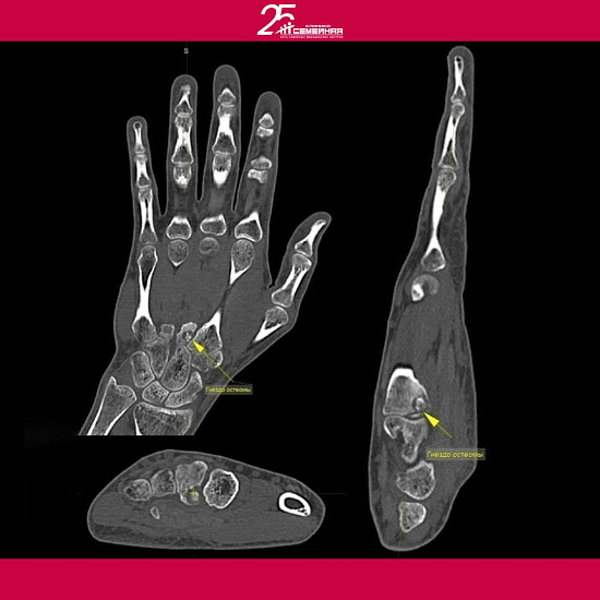 Все валится из рук