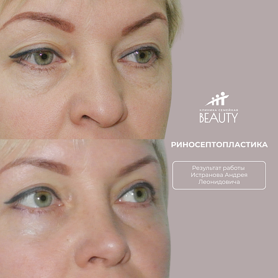 Примеры работ пластического хирурга Истранова А.Л.