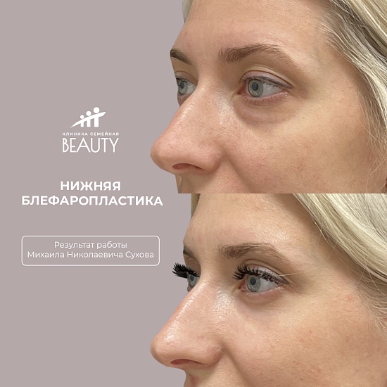 Примеры работ пластического хирурга Сухова М.Н.