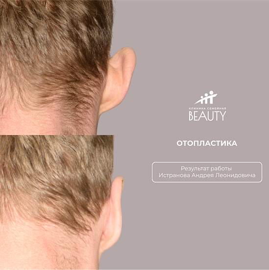 Примеры работ пластического хирурга Истранова А.Л.