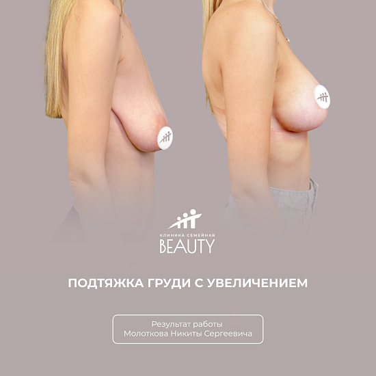 Примеры работ пластического хирурга Молоткова Н.С.