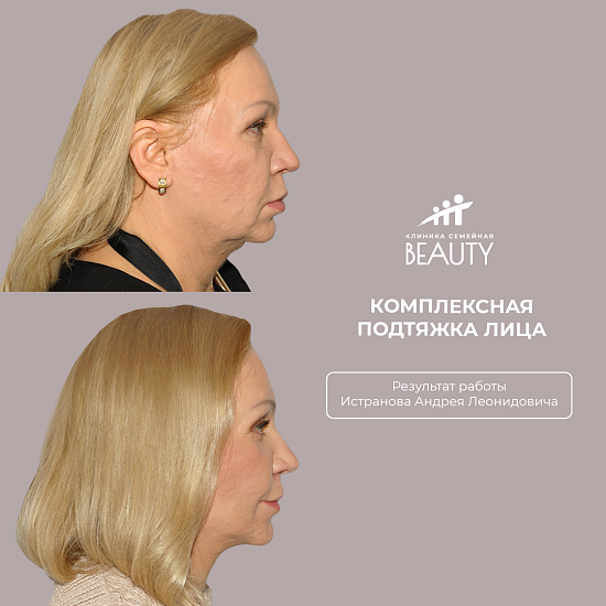 Примеры работ пластического хирурга Истранова А.Л.