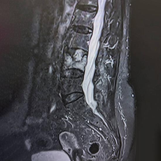 Что скрывают боли в пояснице?