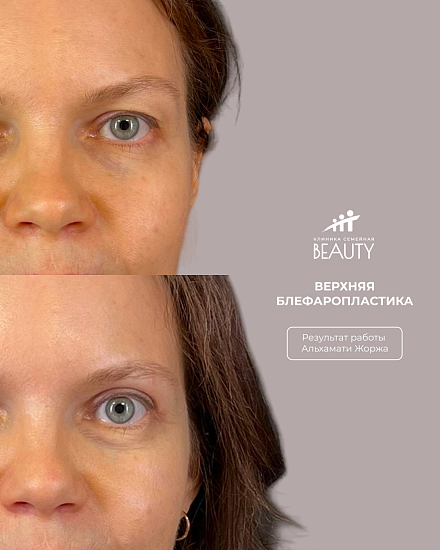 Примеры работ пластического хирурга Альхамати Ж.В.