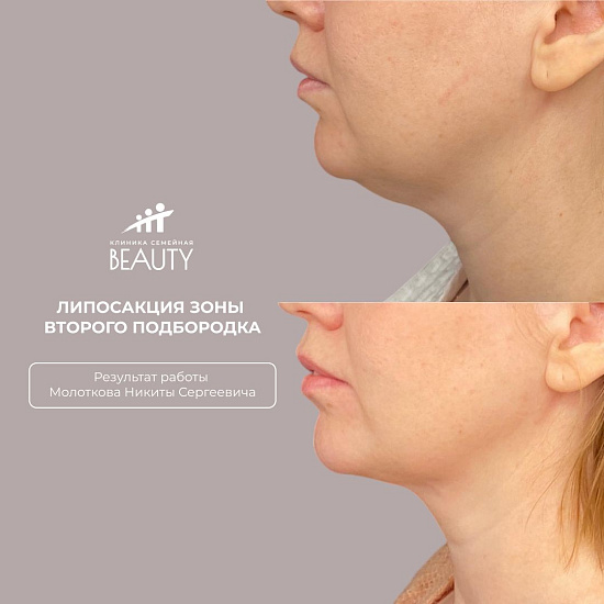 Примеры работ пластического хирурга Молоткова Н.С.