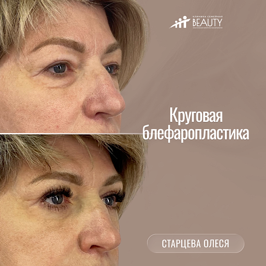 Примеры работ пластического хирурга Старцевой О.И.