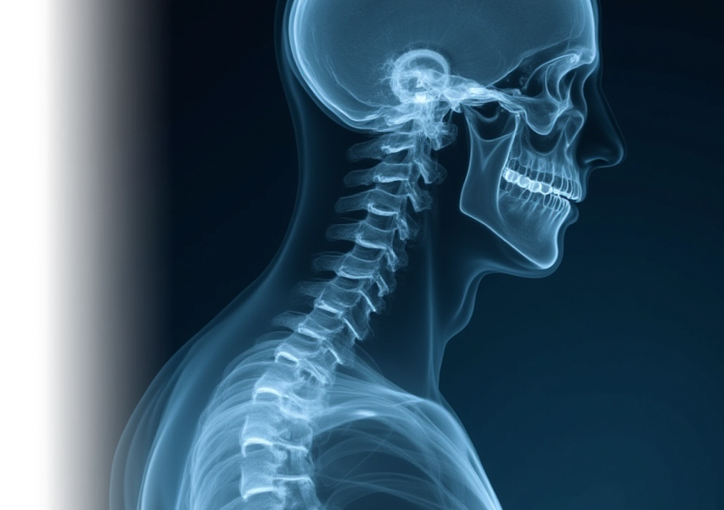 КТ отделов позвоночника