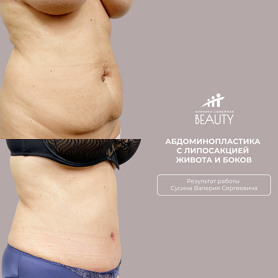 Примеры работ пластического хирурга Сусина В.С.