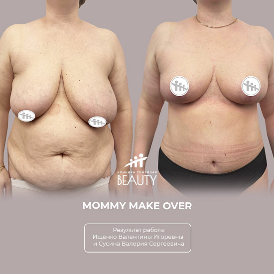 Примеры работ пластического хирурга Ищенко В.И.