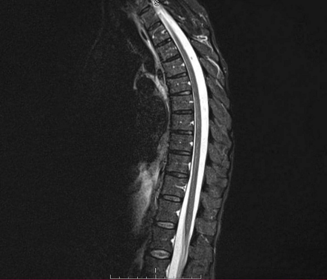 Болит спина