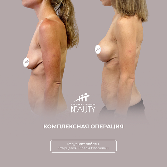 Примеры работ пластического хирурга Старцевой О.И.